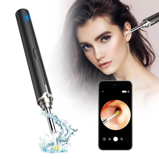 Intelligent Visual Ear Otoscope Inspection Tool Otarealm